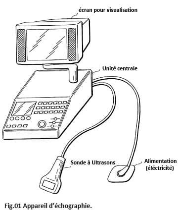 Echographie, échographe