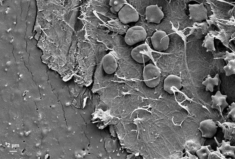 Réseau de fibrine observé au microscope.