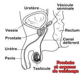 Structure du pelvis pour expliquer le cancer de la prostate