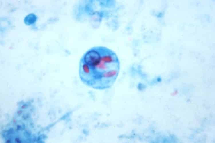 Entamoeba histolytica