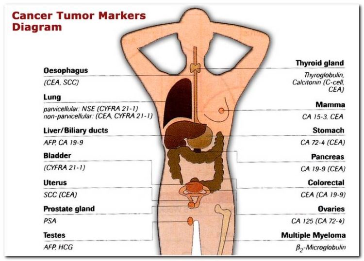 Principaux marqueurs tumoraux